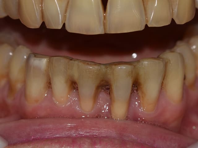 Paciente 6 - Image 1