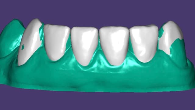 Paciente 4 - Image 3