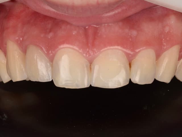 Paciente 5 - Image 2