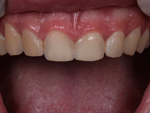 Paciente 5 - Image 1