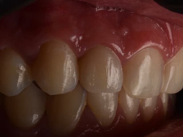 Paciente 5 - Image 3