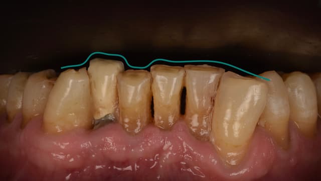 Paciente 2 - Image 1