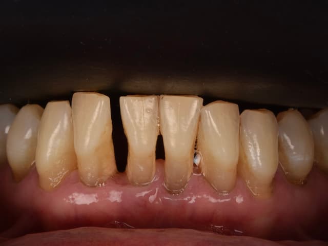 Paciente 1 - Image 2