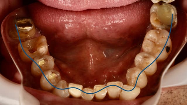 Paciente 2 - Image 4
