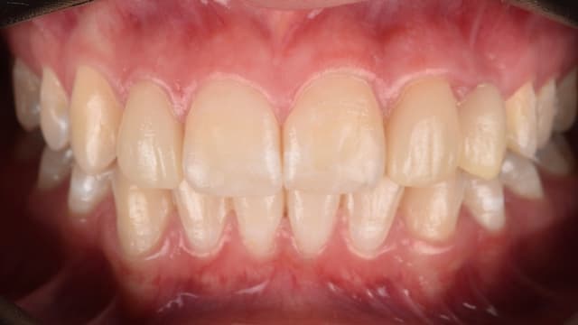 Paciente 3 - Image 3