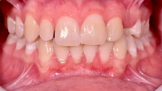 Paciente 3 - Image 2